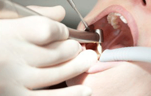  Clínica Dental María Dolores Alfaro Aroca y José María Martínez Utrilla endodoncia